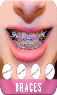 牙套拍照網紅拍照,網紅牙套拍照新風尚