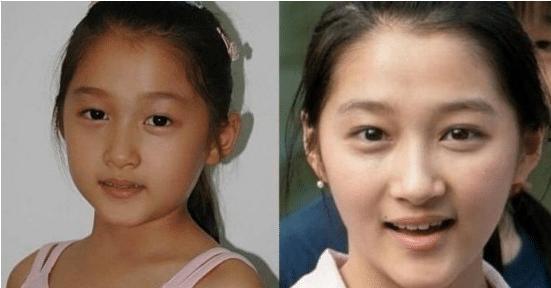 小時(shí)候長(zhǎng)得丑的明星,盤(pán)點(diǎn)小時(shí)候長(zhǎng)得丑的明星蛻變之路